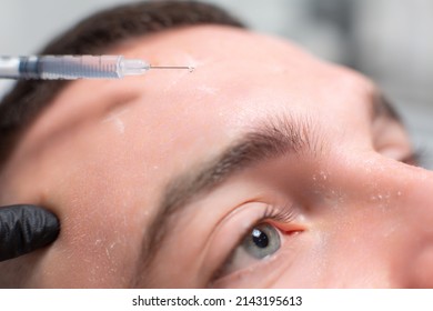 Close Up Of A Drop Of A Drug Falling From A Syringe Needle On The Forehead Of A Male Patient Of A Cosmetology Office. Rejuvenation Procedure, Botox Injections Against Facial Wrinkles