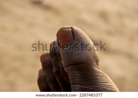 Close up dry foot fingers. Older man feet fingers - dry skin - Shallow focus blur background. Dry skin on the sole and cracked toes. Medical hardware. 