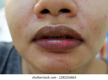 Close up Dry lips and dark color lips of women caused by dehydration and smoking.


