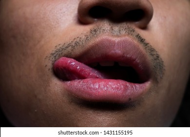 Close Up Dry Lips And Tongue Of Man With Short Beard Above His Mouth.