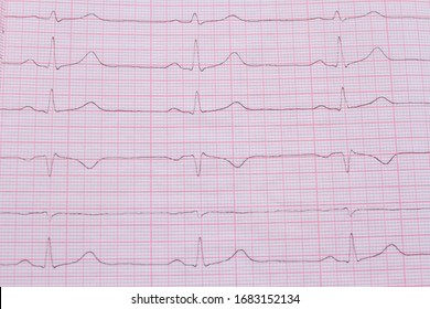 70,064 Electrocardiogram Images, Stock Photos & Vectors | Shutterstock