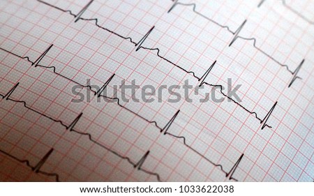 Close up of ECG paper graph report Background                               