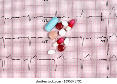 Close Up Echocardiograph Test Report (ECG) Showing Abnormal Heart Rhythm With Medication