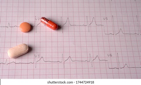 Close Up Echocardiograph Test Report (ECG) Showing Abnormal Heart Rhythm With Medication.