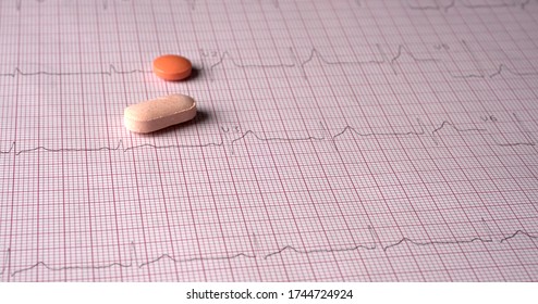 Close Up Echocardiograph Test Report (ECG) Showing Abnormal Heart Rhythm With Medication.