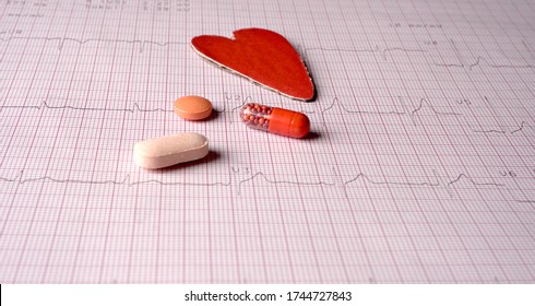 Close Up Echocardiograph Test Report (ECG) Showing Abnormal Heart Rhythm With Medication.