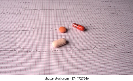 Close Up Echocardiograph Test Report (ECG) Showing Abnormal Heart Rhythm With Medication.