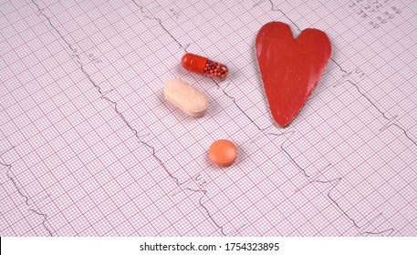 Close Up Echocardiograph Test Report (ECG) Showing Abnormal Heart Rhythm With Medication.