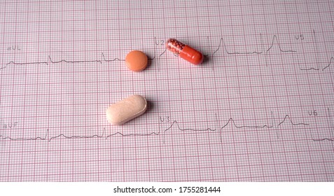 Close Up Echocardiograph Test Report (ECG) Showing Abnormal Heart Rhythm With Medication.