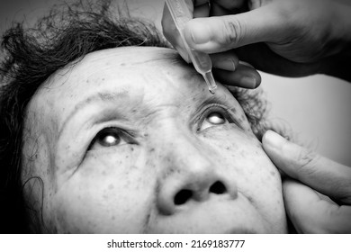 Close Up Of Elder Woman Drips Eye Drops Into Her Eyes. Treatment For Eye Diseases. Healthcare Concept. Black And White Tone