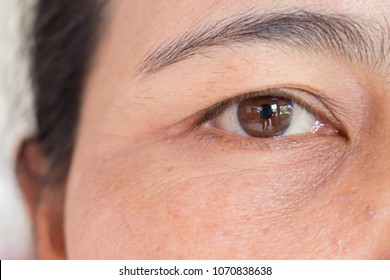 Close Up Of Eye Asian Woman