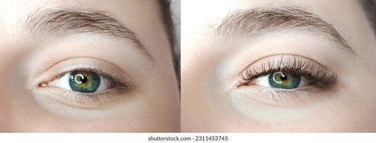 close up of eyelash extensions in beauty salon macro eye.2d ,3d ,russian volume, mega volume,kim k, classical lashes, before and after treatment - Powered by Shutterstock