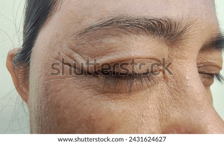 Close eyes with crow's feets and lower eyelid bags, Facial skin problems of freckles, dark spots and wrinkles on the faces of Asain women, Rough skin, Isolated on white background and beauty concept