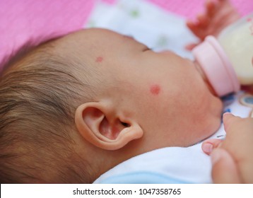 Kid Allergy Milk High Res Stock Images Shutterstock