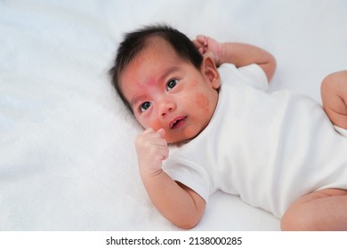 Close Up Face Of Newborn Baby With Atopic Eczema On The Cheek, Concept Of Healthcare And Skin Dermatitis Problem In The Newborn Baby With Allergy Of Sensitive Skin.