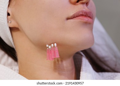 Close up face of thread lifting procedure. Professional cosmetologist in pink medical gloves inserting needles in chin scin. Anti-aging treatment and face lift in cosmetology clinic. Pretty woman fac
