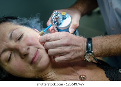 Close Up Of Face Of Woman In 50s Receiving Local Cryotherapy. Beauty Treatment Using Vaporized Nitrogen.