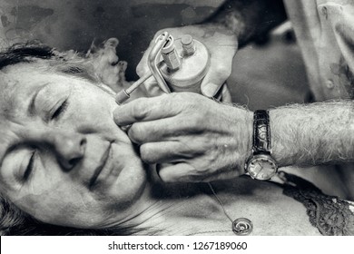 Close Up Of Face Of Woman In 50s Receiving Local Cryotherapy. Beauty Treatment Using Vaporized Nitrogen.