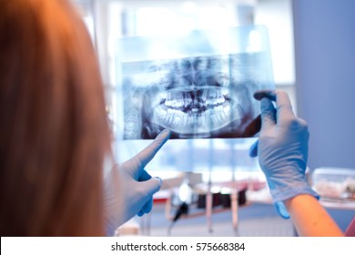 Close up female dentist pointing at patient's X-ray image in dental office.