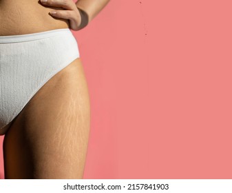 Close up female legs with stretch marks on pink background.