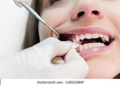 Close Up Of Female Patient With A Gauze In Her Mouth At Dentist.