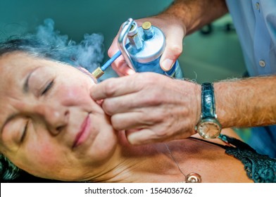 Close Up Of Female Receiving Local Cryotherapy Treatment To Her Face. Nitrogen Vapors Applied.