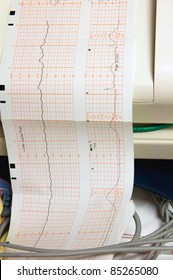 Close Up Of A Fetal Heart Rate Monitor Printout