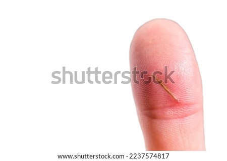 close up of finger with splinter, infection, finger injury, copy space