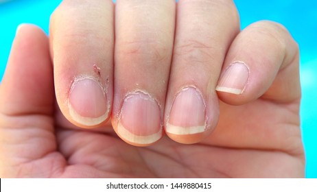 58,176 Cuticle Images, Stock Photos & Vectors | Shutterstock