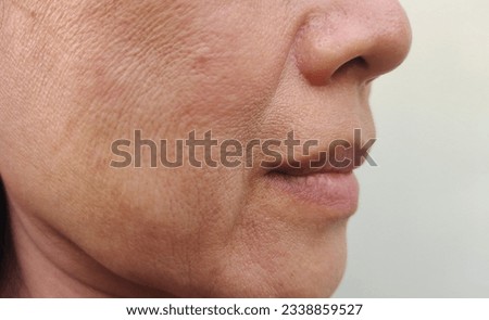 close up the flabbiness and wrinkle beside the mouth, Flabby skin, dark spots and rough skin, blemish, the mouth dry skin, freckles and pore on the face of the woman, health care and beauty concept.