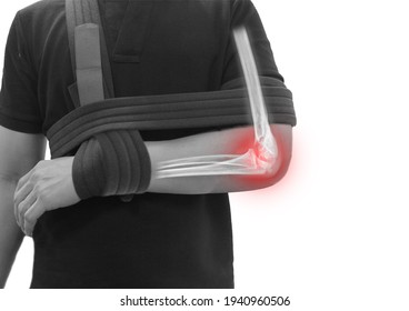 Acercar el dolor por fractura de antebrazo y codo en un hombre, joven sostiene su antebrazo en síntomas de inflamación de codo dolor concepto de atención médica.
