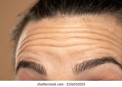 Close Up Of Forehead With Wrinkles Of Young Woman.