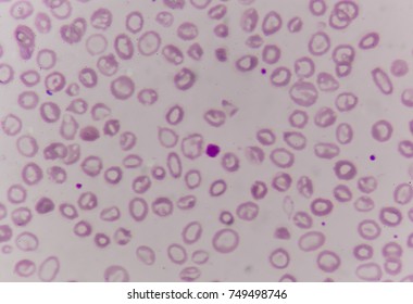 148 Giant Platelets Images, Stock Photos & Vectors | Shutterstock