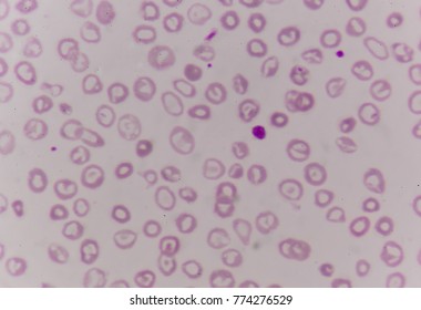 6,131 Platelets Blood Stock Photos, Images & Photography | Shutterstock