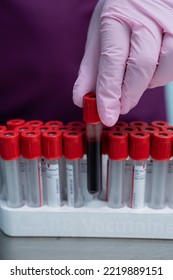 Close Up Of Gloved Hand Placing A Vial Full Of Blood Into A Tray Of Empty Vials.