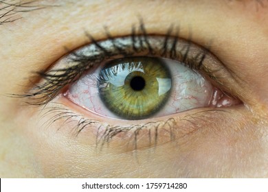 Close Up Of A Green Eye With Dilated Capillaries