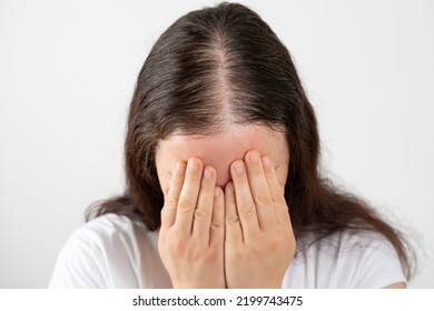 Close up of hair loss woman stressed and crying over rapid hair loss against white background - Shutterstock ID 2199743475