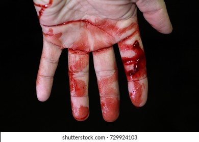 Close Up Hand Injury, Finger Cut With Knife, Real Bloody Hand 