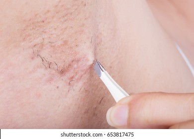 close up hand of woman plucking hair in her armpit