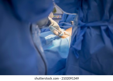 A Close Up Of Hands Of Surgeons Team During Operation Gall Bladder Stone Removal With Surgical Laparoscopy Instruments. Key Hold Surgery In Cholecystitis With Abdominal Pain. 