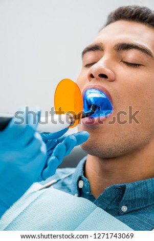 close up of handsome african american man during whitening procedure 