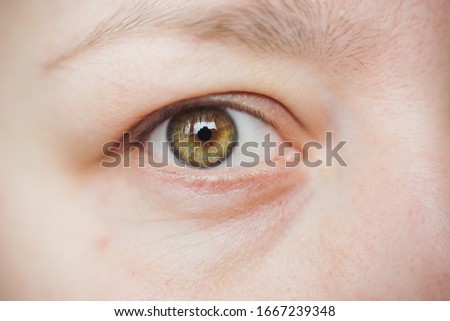 close up hazel eye, no make up, no edit
