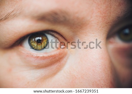 close up hazel eye, no make up, no edit