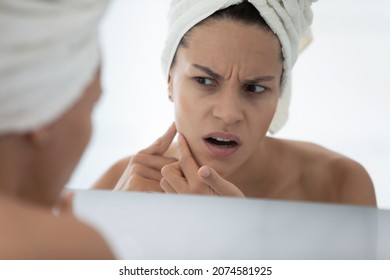 Close Up Head Shot Mirror Reflection Stressed Young Hispanic Latin Woman Touching Cheek, Worrying About Acne Breakout Pimples Skin Problems, Annoyed By Blackheads, Daily Cosmetology Treatment Concept