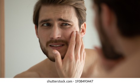 Close Up Head Shot Unhappy Man Looking In Mirror, Feeling Stressed Of Sensitive Skin Or Acne Breakout, Thinking Of Cosmetology Treatment. Depressed Young Guy Dissatisfied With Skin Condition.