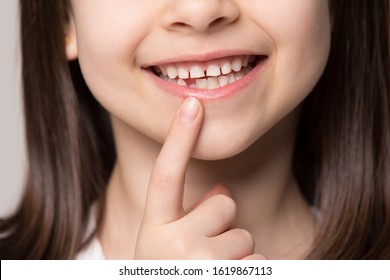 Close Up Headshot Cropped Image Little Preschool Cute Girl Widely Smiling, Showing Empty Space With Growing First Permanent Molar. Happy Six Years Old Small Adorable Cutie Losing Primary Baby Teeth.