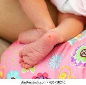 Close Up Of The Heel Of A Newborn Baby Girl. Detail Of The Blood Samples.