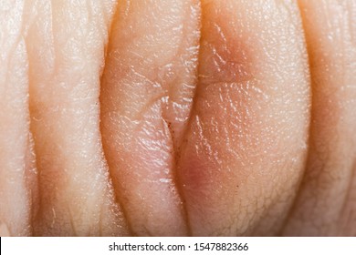 Close Up Human Skin. Macro Epidermis Texture. Pores And Folds Of Human Skin. Dry Skin.