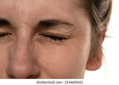 Close Up Image Of Female Eye Wrinkles.