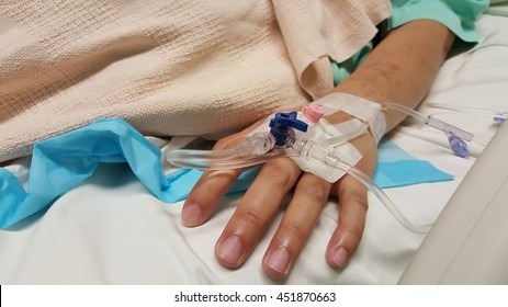 Close Image Of Iv Cannula(catheter) On Left Hand.